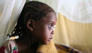 Sheleme au centre de renutrition thérapeutique de MSF sud de l'Ethiopie