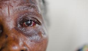 Cette femme de 70 ans a été victime de violences sexuelles. Ses voisins l'ont amenée au centre de santé de Biakoto où elle a pu recevoir des soins médicaux et psychologiques.