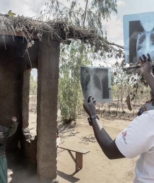 Prise en charge des adolescents atteints de VIH/Sida à Chiradzulu, au Malawi. Juillet 2017