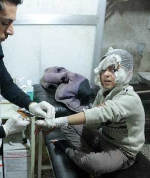 Un enfant victime de brûlures, pris en charge par MSF à Atmeh, dans le nord de la Syrie, en février 2015.