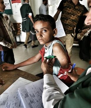 Un jeune garçon âgé de 12 ans été blessé par des éclats d'obus aux bras et aux jambes, à la suite d'un bombardement aérien qui a frappé sa maison dans le village d'Al-Bajah, dans la région de Sanah à Qatabah. Septembre 2016.