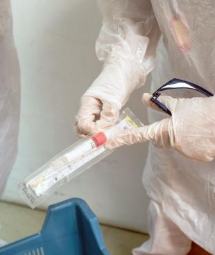 Le test virologique Polymerase Chain Reaction (PCR) sert au dépistage de la Covid-19. Ses résultats sont obtenus sous 48 heures.