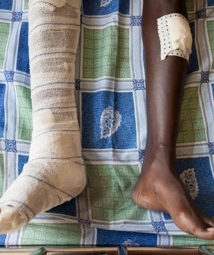 Un patient dans le Centre de traumatologie MSF à Bujumbura, au Burundi. Décembre 2015.