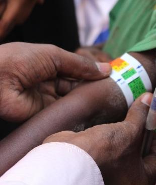 Un médecin mesure le poignet d'un enfant pour le dépistage de la malnutrition, à Asbuli, en Éthiopie. Février 2016. 