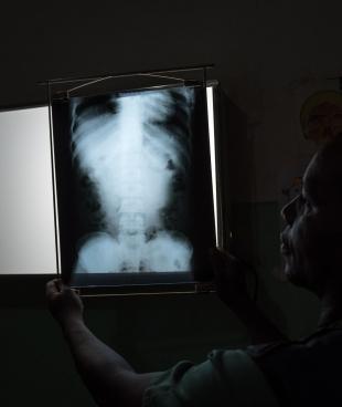 Un radiologiste de Médecins Sans Frontières examine un scanner à l'hôpital de Bangassou en République centrafricaine. 2017.