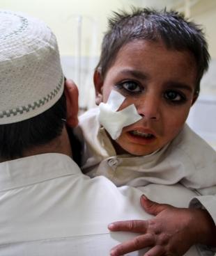 Au Pakistan, dans le centre de santé MSF contre la leishmaniose cutanée