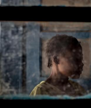 Une survivante de violences sexuelles, dans l'hôpital général de référence de Salamabila, où travaillent les équipes MSF. République démocratique du Congo. 