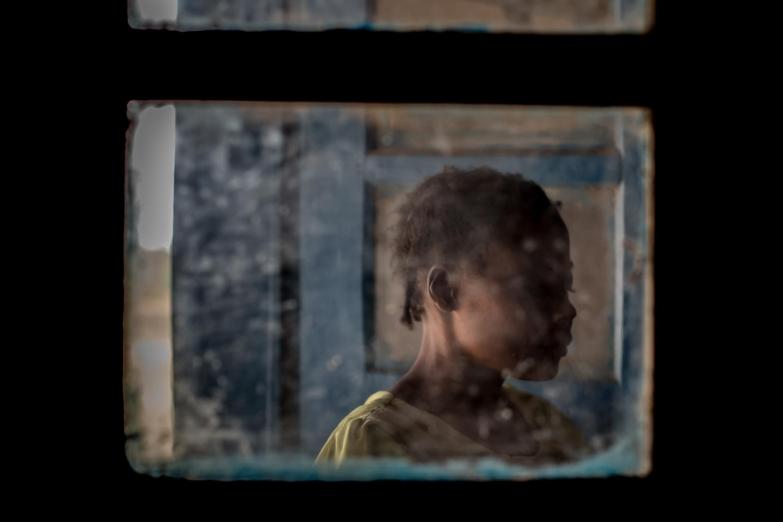 Une survivante de violences sexuelles, dans l'hôpital général de référence de Salamabila, où travaillent les équipes MSF. République démocratique du Congo.