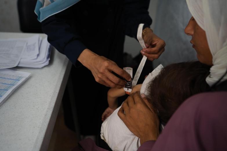 Un enfant palestinien souffrant de malnutrition passe un examen médical dans la clinique MSF à Gaza.