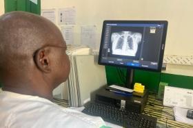 République centrafricaine : l’IA au service du dépistage de la tuberculose  