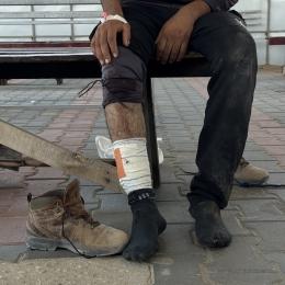 Un patient âgé de 32 ans, blessé par balle alors qu'il allait chercher de la nourriture pour sa famille dans un centre de distribution de la "Gaza Humanitarian Foundation", organisation orchestrée par Israël et les États-Unis. Il a été pris en charge par les équipes de MSF. Gaza, juin 2025