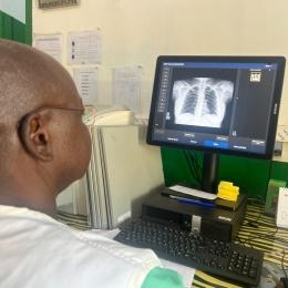 République centrafricaine : l’IA au service du dépistage de la tuberculose  