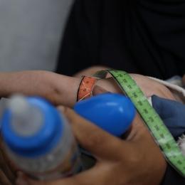 Malnutrition à Gaza
