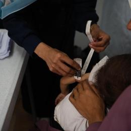 Un enfant palestinien souffrant de malnutrition passe un examen médical dans la clinique MSF à Gaza.