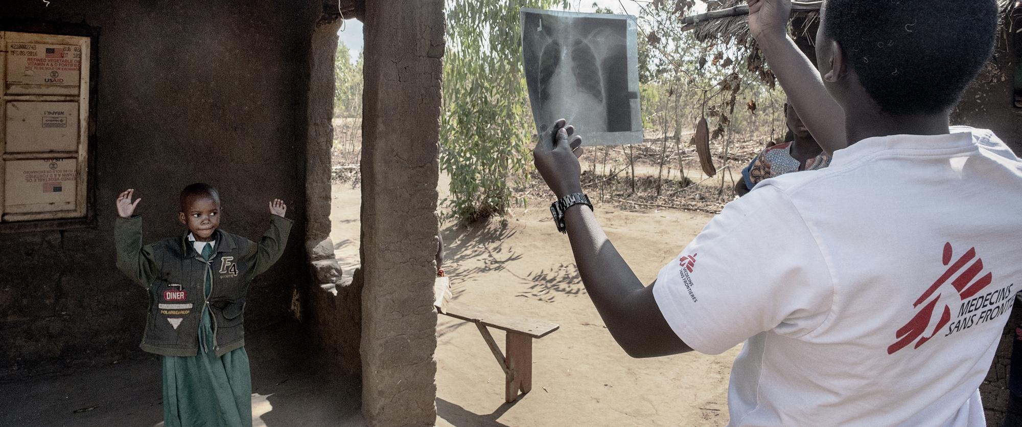 Prise en charge des adolescents atteints de VIH/Sida à Chiradzulu, au Malawi. Juillet 2017