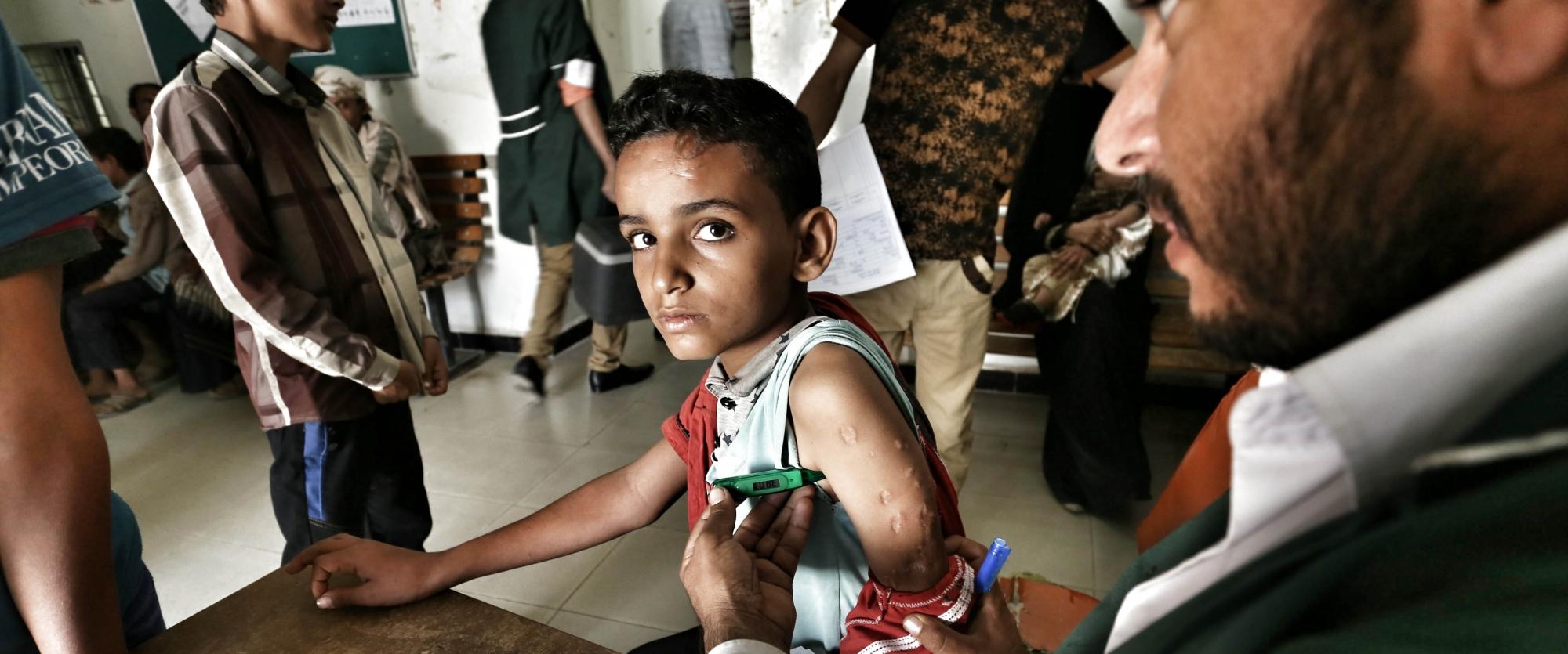 Un jeune garçon âgé de 12 ans été blessé par des éclats d'obus aux bras et aux jambes, à la suite d'un bombardement aérien qui a frappé sa maison dans le village d'Al-Bajah, dans la région de Sanah à Qatabah. Septembre 2016.
