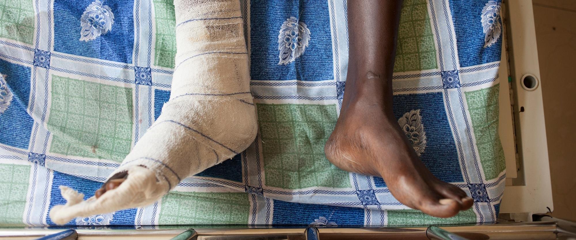 Un patient dans le Centre de traumatologie MSF à Bujumbura, au Burundi. Décembre 2015.