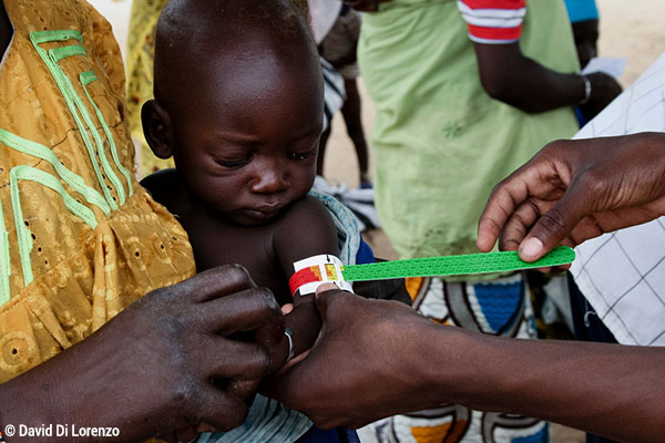 David Di Lorenzo  La malnutrition est détectée rapidement et facilement grâce à l’utilisation du bracelet MUAC. Région de Zinder, Niger