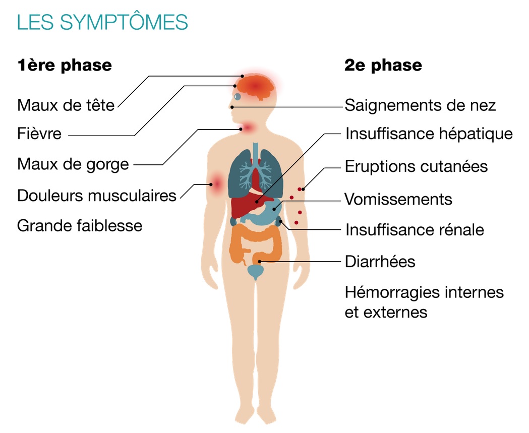 Infographie Ebola RFI